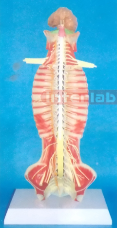 SMALL HUMAN SPINAL CORD MODEL IN SPINAL CANAL